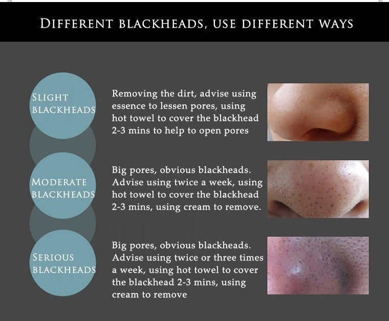 Bamboo Charcoal Blackhead Remover